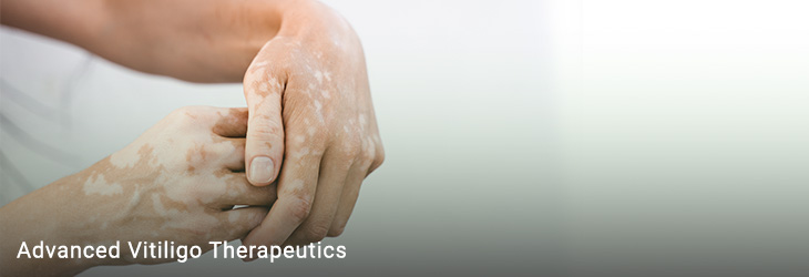 Advanced Vitiligo Therapeutics